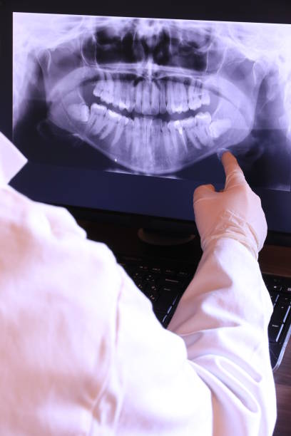 Best Knocked-Out Tooth Emergency  in Spencerville, OH