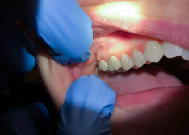 Best Emergency Dentist Near Me  in Spencerville, OH