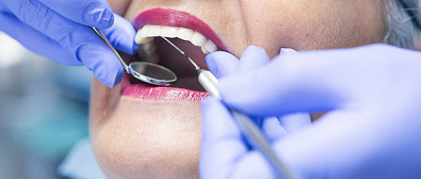 Best Root Canal Emergency Dentist  in Spencerville, OH